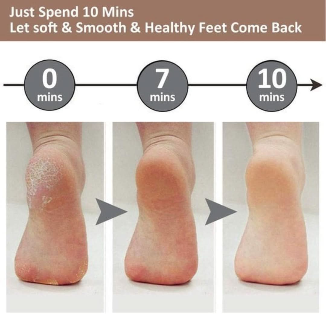 Callus Remover - Rechargeable-Callus Remover-VyFlair