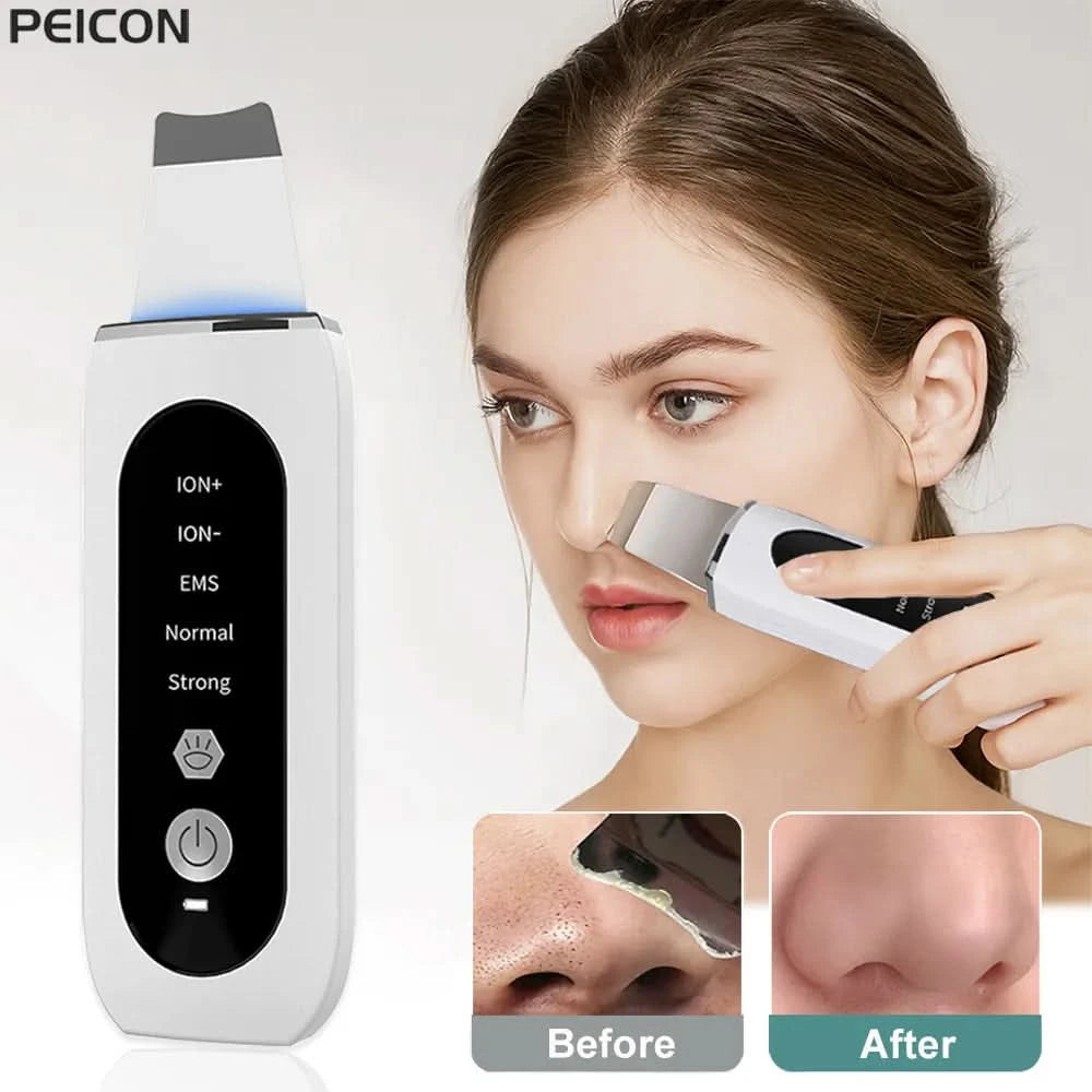 Scrubber ultrasónico 5-en-1 Scrubber ™-facial scrubber-VyFlair