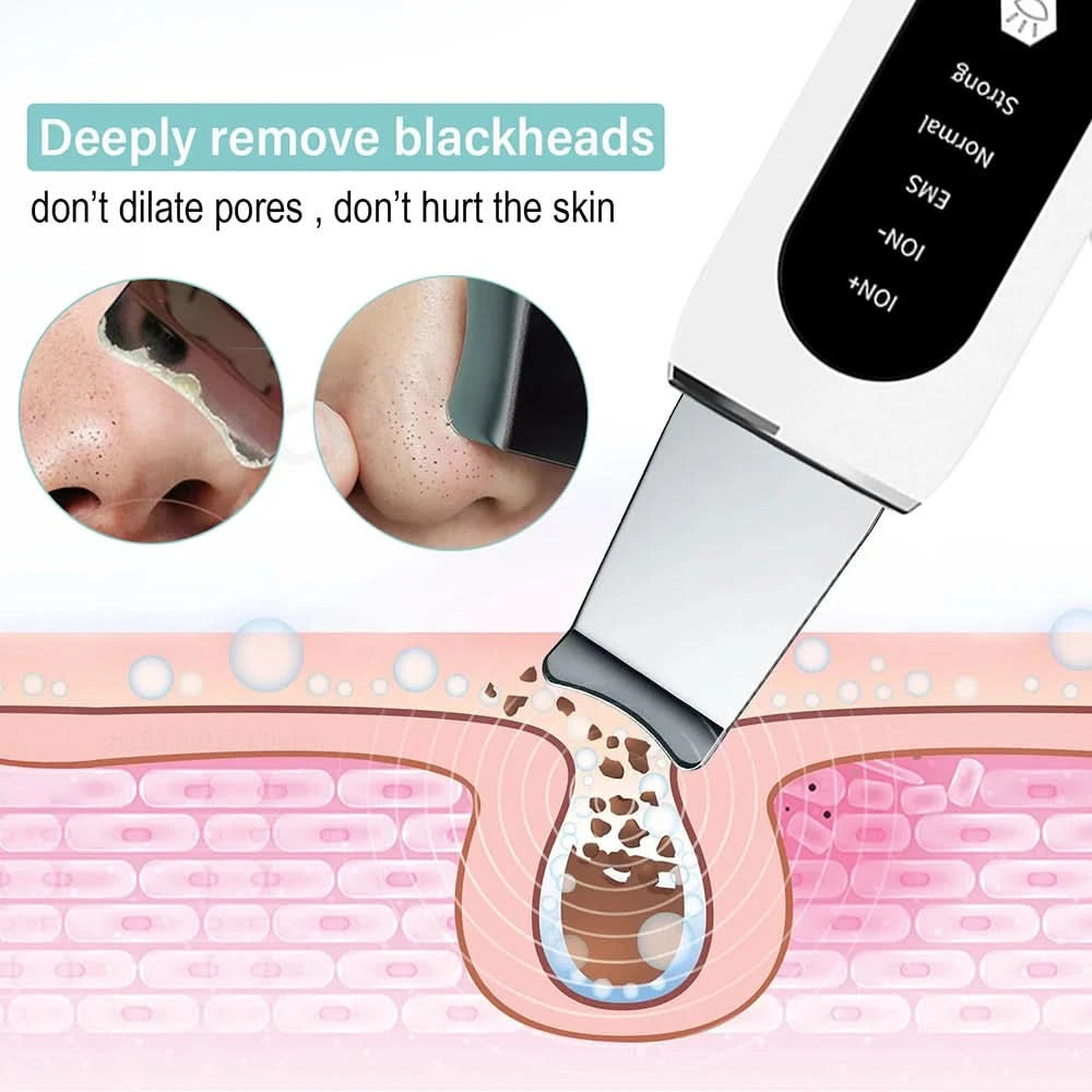 Scrubber ultrasónico 5-en-1 Scrubber ™-facial scrubber-VyFlair