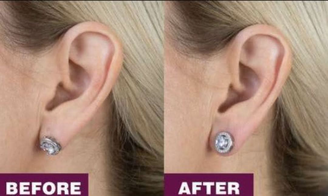 Juego de levantadores de aretes-Beauty-VyFlair