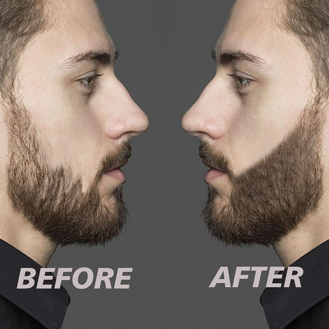 Beardfiller Set: ¡la barba más apretada y completa para todos los hombres!-personal care-VyFlair