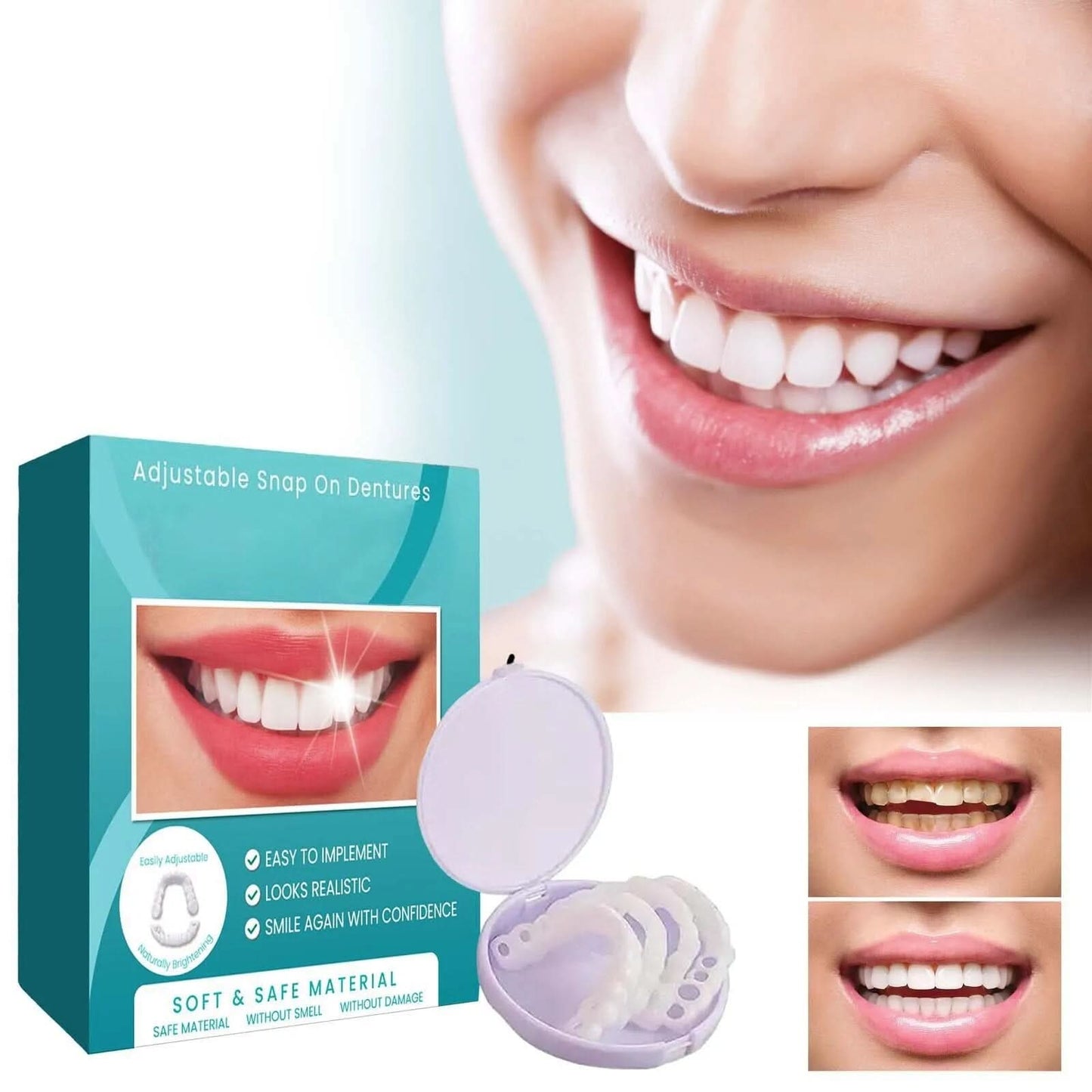 Prótesis Snap-on-dental | Ajustable-VyFlair