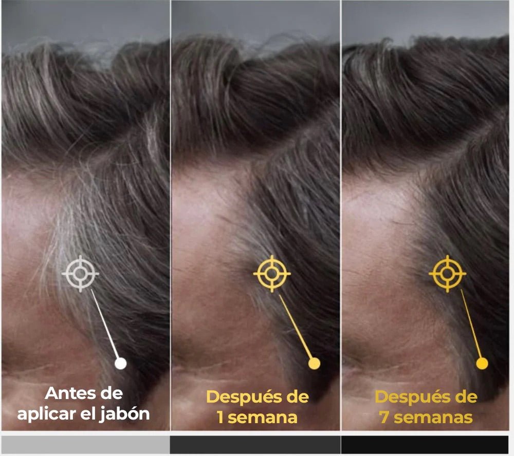 Jabón Anticanas Natural para Cabello y Barba | Vyflair - VyFlair