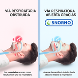 Boquilla Anti-Ronquidos Comodidad Premium