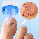 Láser Antihongos para Uñas Portátil y Seguro