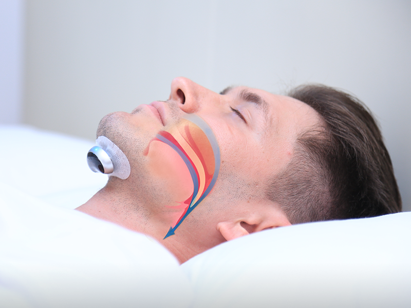 QuietWave Dispositivo Antironquidos con Pulsos Eléctricos