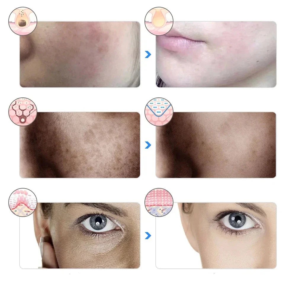AgeGlow - Máscara de Terapia LED de 7 Colores para Lifting Facial y Blanqueamiento