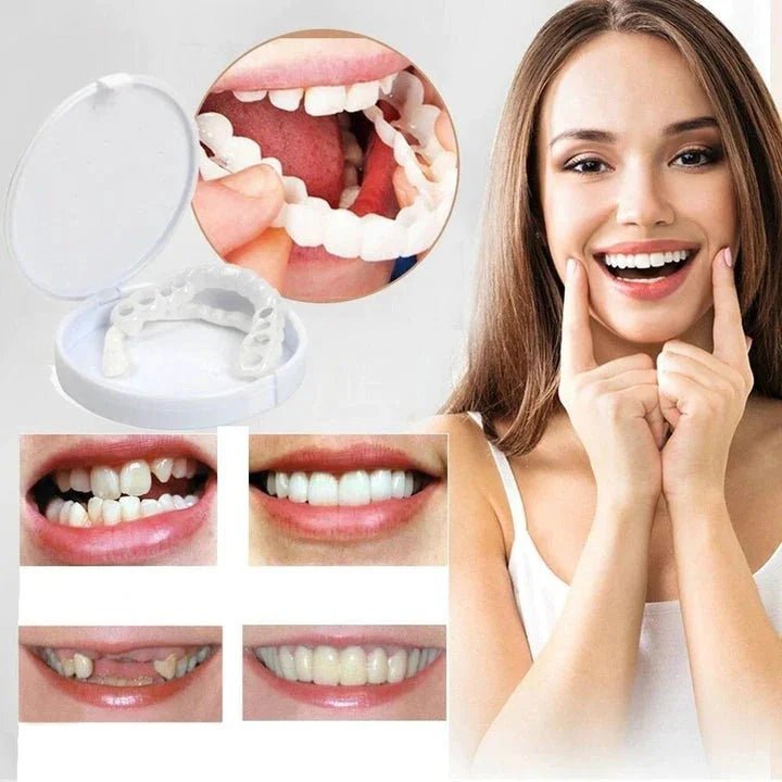Carillas Snap - On Smile Instantáneas y Reutilizables - VyFlair