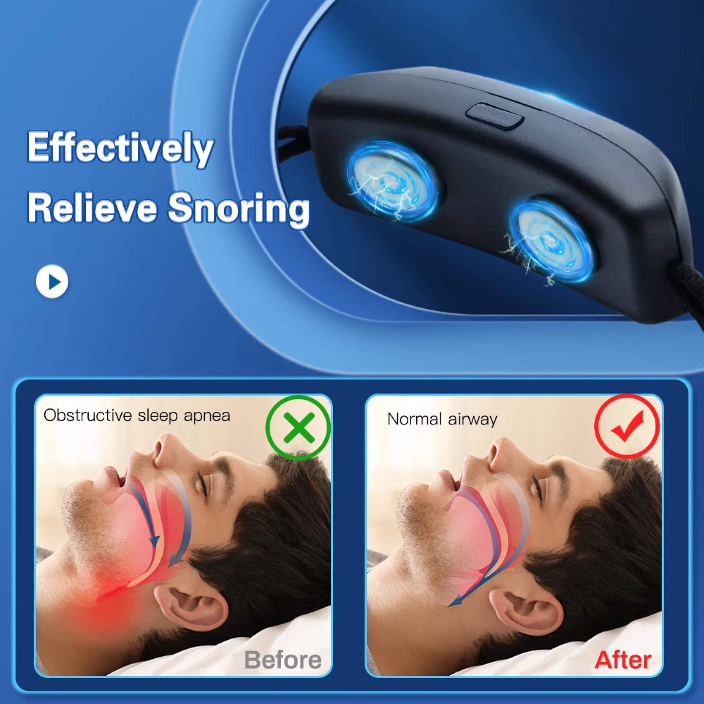 Hypnos - Eficaz sistema antirraquetas con barboquejo