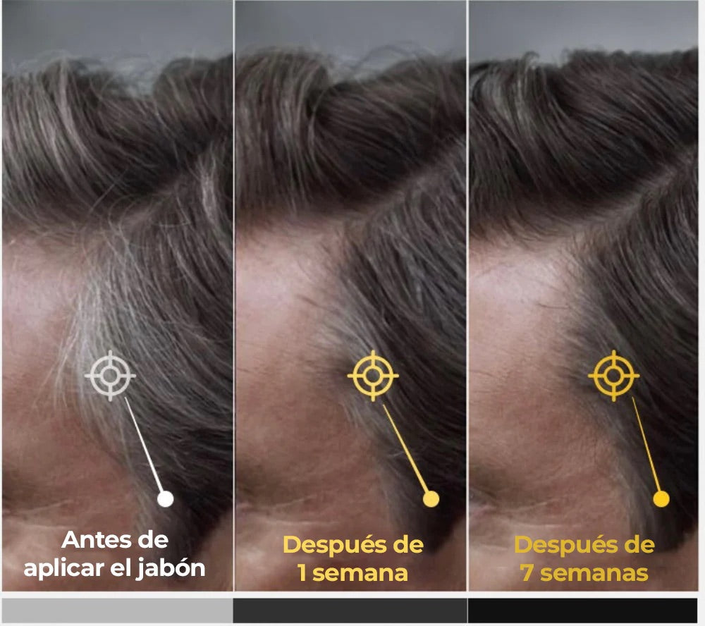Jabón Anticanas Natural para Cabello y Barba | Vyflair
