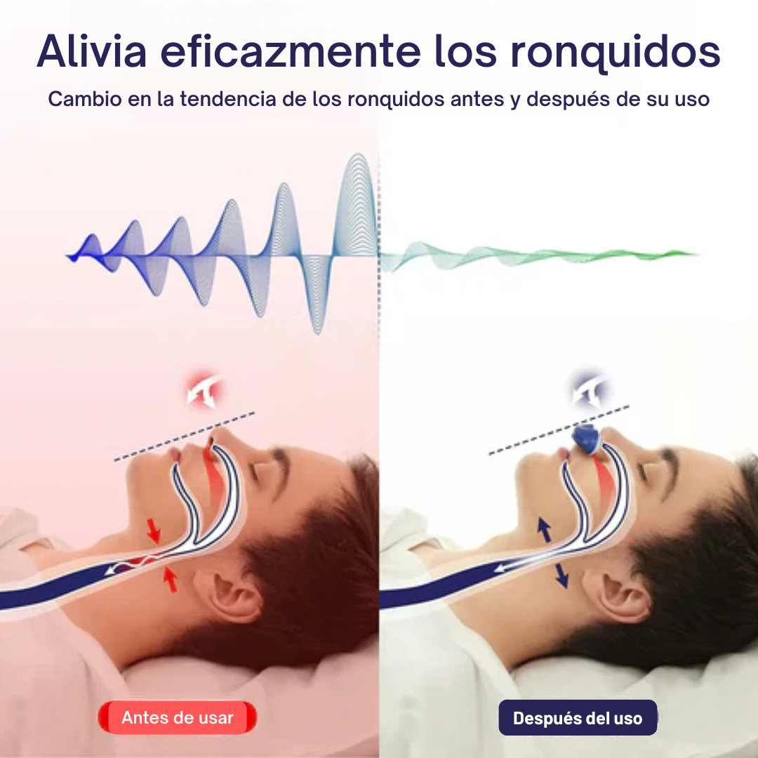 Micro CPAP Portátil Anti-Ronquidos Apnea del Sueño